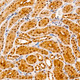 Anti-TRIM25 antibody (190-630) (STJ114804) – Figure 1 of 1