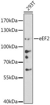 Anti-EEF2 antibody (1-290) (STJ114864) – Figure 1 of 1