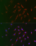 Anti-TSC2 antibody (1160-1255) (STJ114890) – Figure 1 of 1