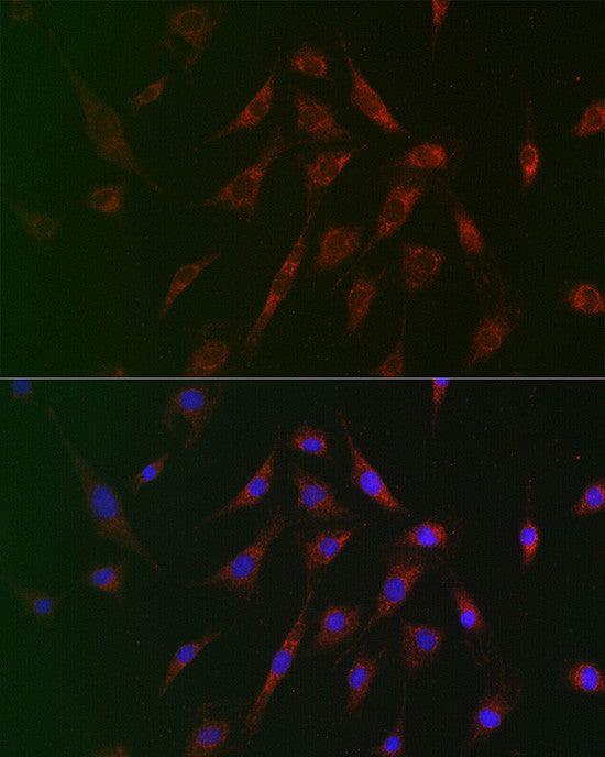 Anti-TSC2 antibody (1160-1255) (STJ114890) – Figure 1 of 1