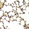 Anti-DDX5 antibody (1-614) (STJ115258) – Figure 1 of 1