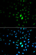 Anti-PIN1 antibody (1-163) (STJ115621) – Figure 1 of 1
