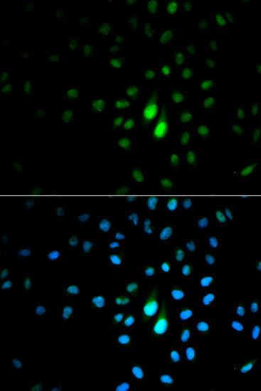 Anti-PIN1 antibody (1-163) (STJ115621) – Figure 1 of 1
