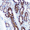 Anti-FCHSD1 antibody (100-400) (STJ117738) – Figure 1 of 1