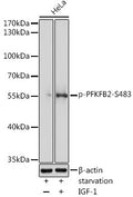 Anti-Phospho-PFKFB2-S483 antibody (STJ117882) – Figure 1 of 1