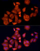 Anti-APAF1 antibody (470-600) (STJ117996) – Figure 1 of 1