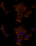 Anti-TSC2 antibody (1531-1807) (STJ118447) – Figure 1 of 1