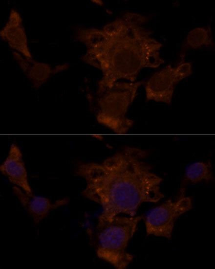 Anti-TSC2 antibody (1531-1807) (STJ118447) – Figure 1 of 1