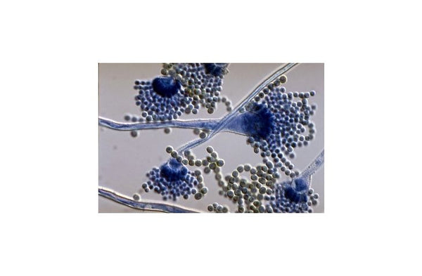 Anti-Aflatoxin B1 & B2 antibody [AFT14/CBL03] (STJ16100224) – Figure 1 of 1