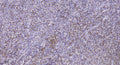 Anti-AHNAK antibody (5720-5800 aa) (STJ190105) – Figure 1 of 1