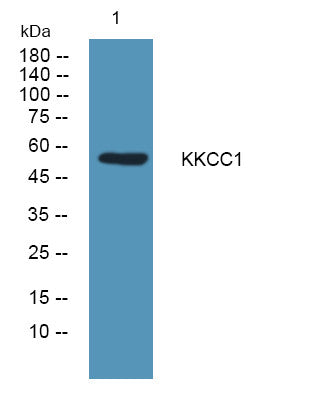 Anti-CAMKK1 antibody (400-480 aa) (STJ190108) – Figure 1 of 1