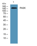 Anti-PASK antibody (1100-1180 aa) (STJ190115) – Figure 1 of 1