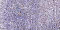 Anti-ROS1 antibody (2210-2290 aa) (STJ190117) – Figure 1 of 1