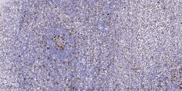 Anti-ROS1 antibody (2210-2290 aa) (STJ190117) – Figure 1 of 1