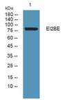 Anti-EIF2B5 antibody (480-560 aa) (STJ190118) – Figure 1 of 1