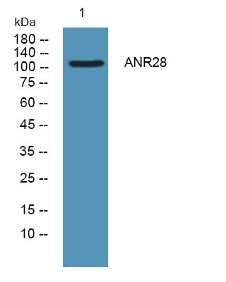 Anti-ANKRD28 antibody (980-1060 aa) (STJ190126) – Figure 1 of 1