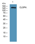 Anti-CLSPN antibody (10-90 aa) (STJ190129) – Figure 1 of 1