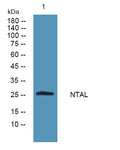 Anti-LAT2 antibody (80-160 aa) (STJ190135) – Figure 1 of 1