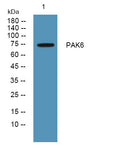 Anti-PAK6 antibody (100-180 aa) (STJ190138) – Figure 1 of 1