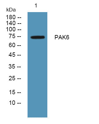 Anti-PAK6 antibody (100-180 aa) (STJ190138) – Figure 1 of 1