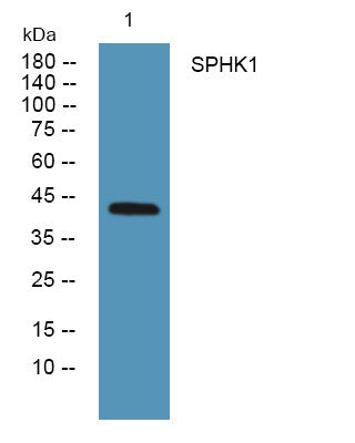 Anti-SPHK1 antibody (160-240 aa) (STJ190139) – Figure 1 of 1