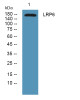 Anti-LRP6 antibody (1420-1500 aa) (STJ190146) – Figure 1 of 1