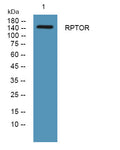 Anti-RPTOR antibody (730-810 aa) (STJ190148) – Figure 1 of 1
