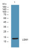 Anti-LSM1 antibody (50-130 aa) (STJ190180) – Figure 1 of 1