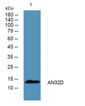 Anti-ANP32D antibody (1-80 aa) (STJ190191) – Figure 1 of 1