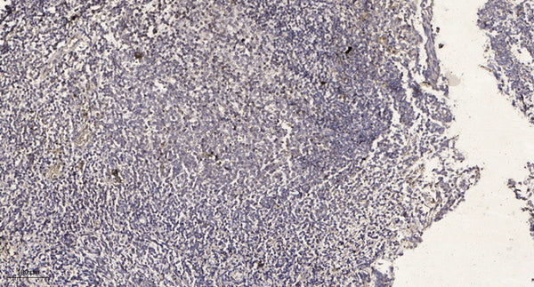 Anti-AKAP6 antibody (30-110 aa) (STJ190212) – Figure 1 of 1