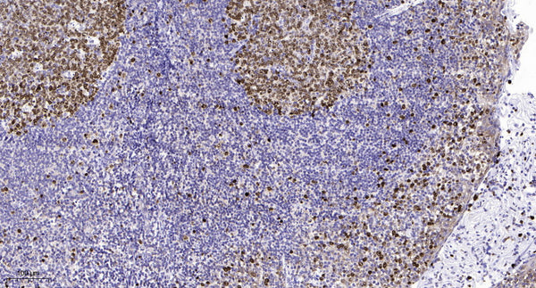 Anti-KMT2B antibody (1060-1140 aa) (STJ190261) – Figure 1 of 1