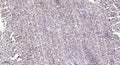 Anti-SRRM2 antibody (2000-2080 aa) (STJ190263) – Figure 1 of 1