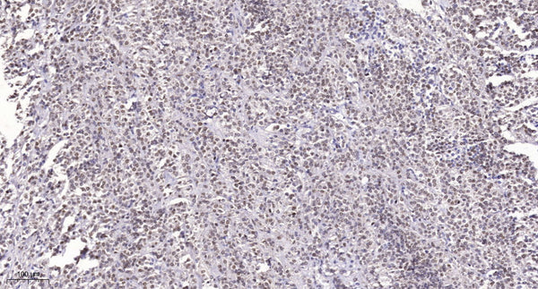 Anti-SRRM2 antibody (2000-2080 aa) (STJ190263) – Figure 1 of 1
