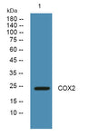 Anti-MT-CO2 antibody (40-120 aa) (STJ190282) – Figure 1 of 1