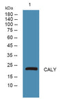 Anti-CALY antibody (1-80 aa) (STJ190297) – Figure 1 of 1
