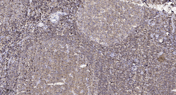 Anti-FAT1 antibody (1140-1220 aa) (STJ190301) – Figure 1 of 1