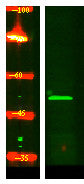 Anti-KRT32 antibody (220-300 aa) (STJ190349) – Figure 1 of 1