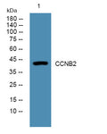 Anti-CCNB2 antibody (60-140 aa) (STJ190397) – Figure 1 of 1