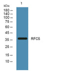 Anti-RFC5 antibody (110-190 aa) (STJ190417) – Figure 1 of 1