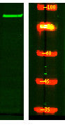 Anti-STRN4 antibody (250-330 aa) (STJ190418) – Figure 1 of 1