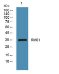Anti-MRPL1 antibody (150-230 aa) (STJ190455) – Figure 1 of 1