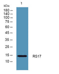 Anti-RPS17 antibody (30-110 aa) (STJ190469) – Figure 1 of 1