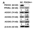 Anti-ACOX3 antibody (480-560 aa) (STJ190505) – Figure 1 of 1