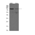 Anti-ADAM9 antibody (120-200 aa) (STJ190515) – Figure 1 of 1