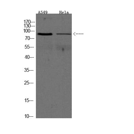 Anti-ADAM9 antibody (120-200 aa) (STJ190515) – Figure 1 of 1