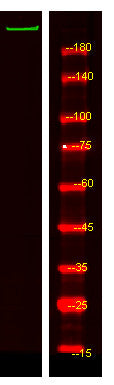 Anti-ADAMTS20 antibody (190-270 aa) (STJ190519) – Figure 1 of 1