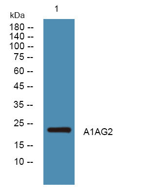 Anti-ORM2 antibody (40-120 aa) (STJ190536) – Figure 1 of 1