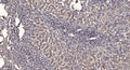 Anti-ABCA12 antibody (2170-2250 aa) (STJ190576) – Figure 1 of 1