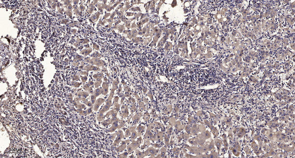 Anti-ABCA12 antibody (2170-2250 aa) (STJ190576) – Figure 1 of 1