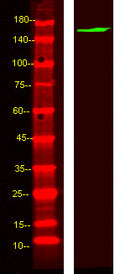 Anti-ABCB11 antibody (STJ190611) – Figure 1 of 1